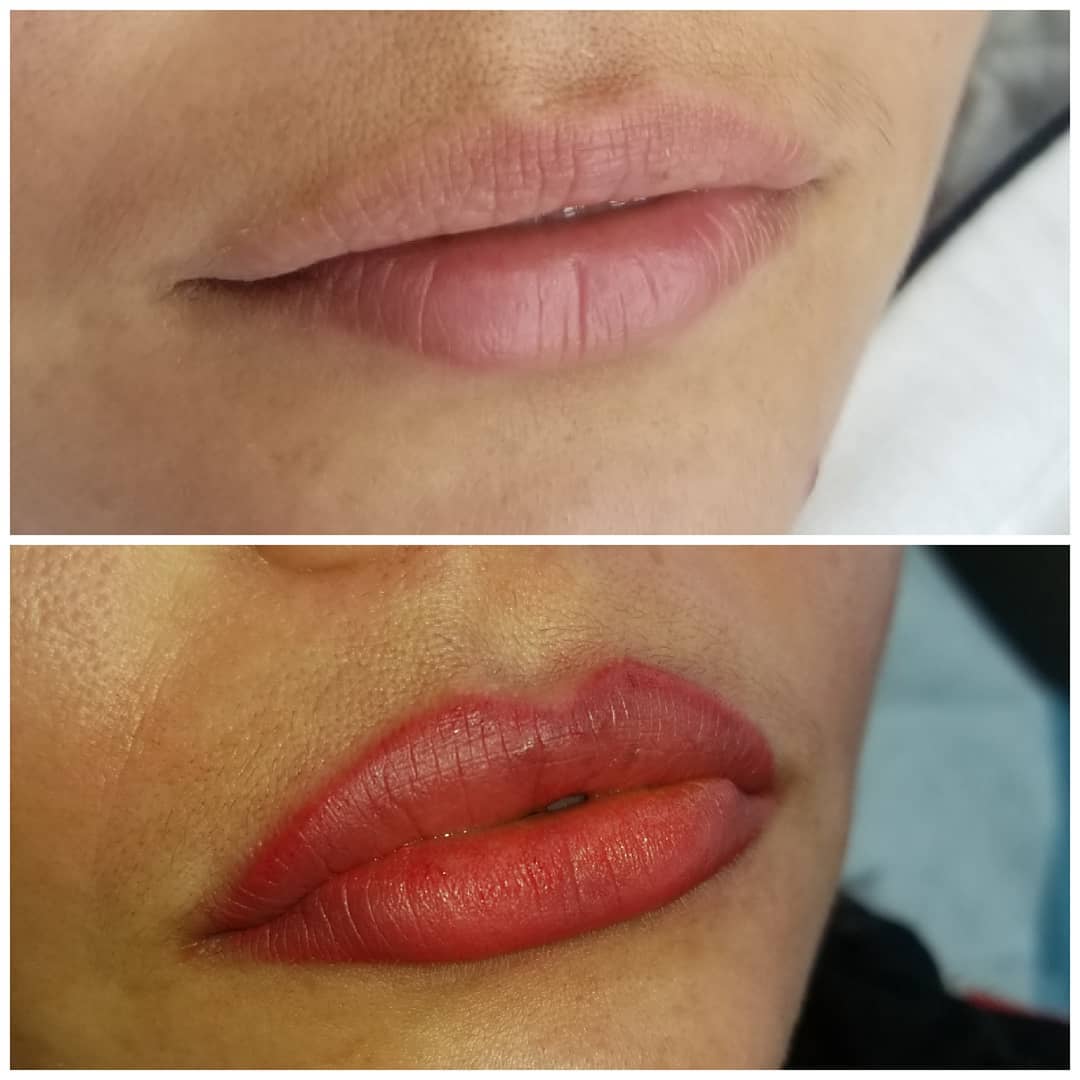 Lip Treatments, Permanent