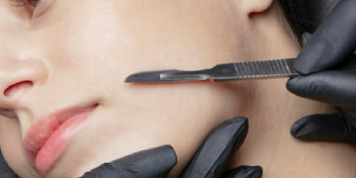What to expect before and after a dermaplaning session.