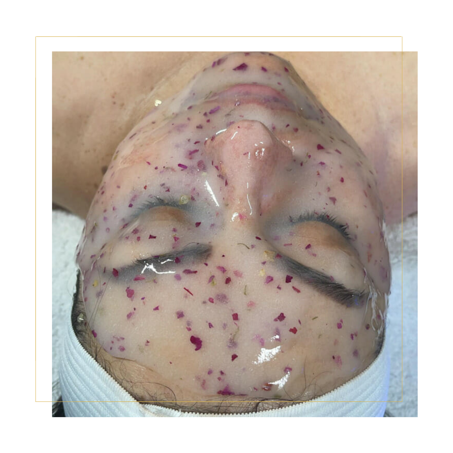 Chemical Peels In Grand Junction, CO