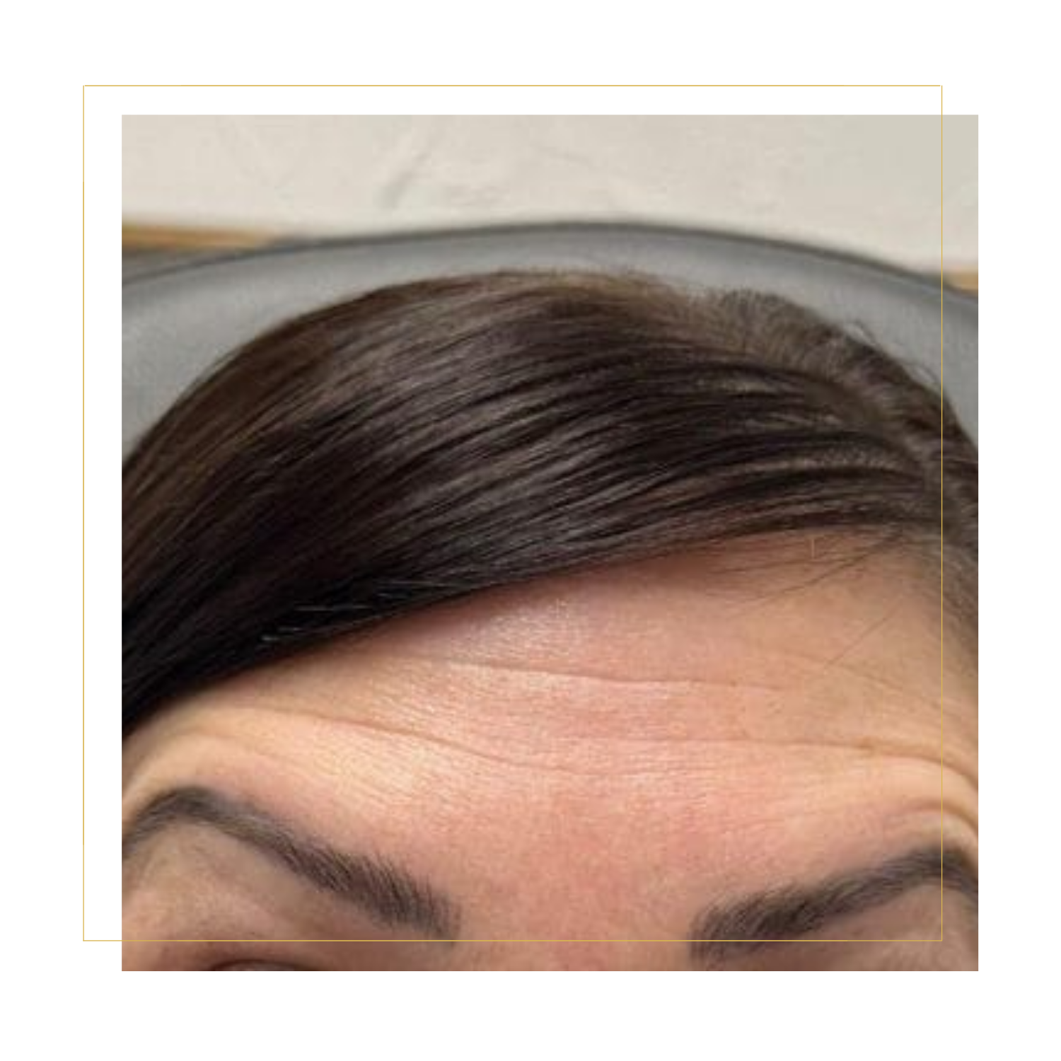 Injectables Grand Junction, CO