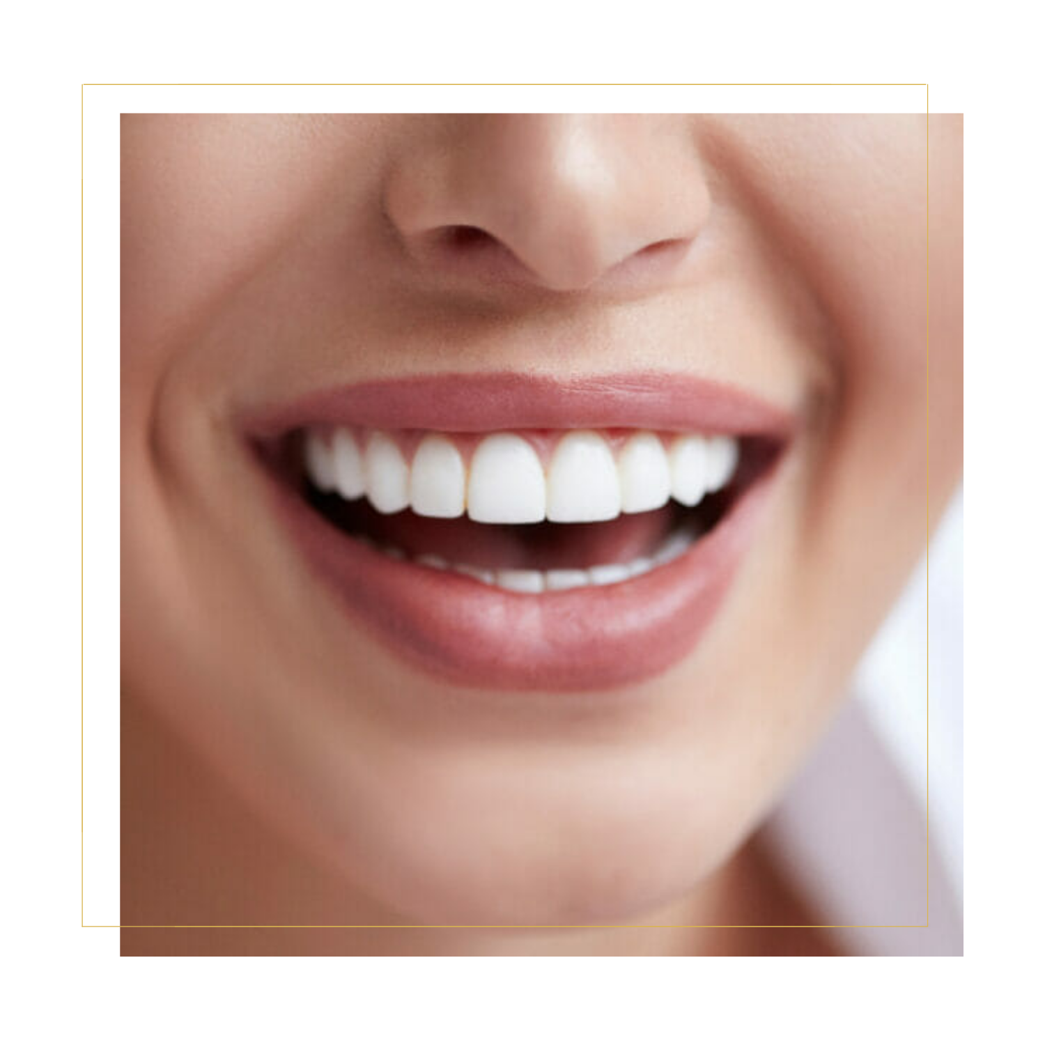 Teeth Whitening In Grand Junction, Colorado